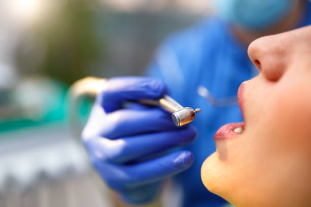 Dental Bonding in Watertown, MN